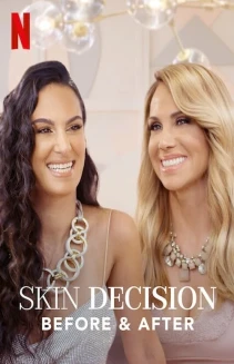 Watch Skin Decision: Before and After online