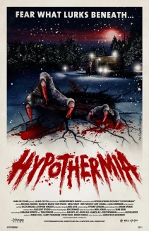 Hypothermia